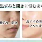 毛穴の黒ずみと開きに悩むあなたへ。おすすめ美容液でツルツル肌へ