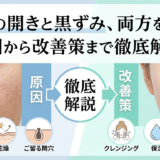 毛穴の開きと黒ずみ、両方をケア。原因から改善策まで徹底解説。